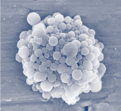 科学家或开发出运输癌症药物的特殊商业化“气泡”结构