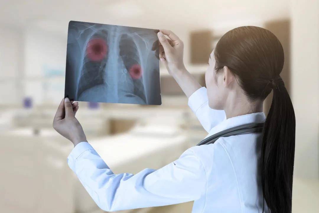 60%肺癌患者秋冬都在问！7大症状提醒治疗困境