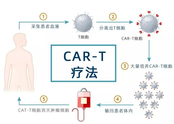 完全缓解长达8年?！中国创新CAR-T疗法为晚期癌症患者带来“治愈”曙光！